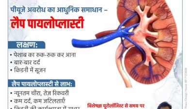 Modern Solution for PUJ Obstruction – Laparoscopic Pyeloplasty